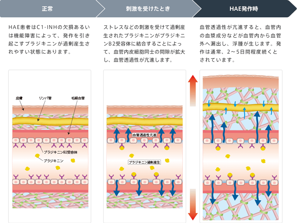 フィラジル®の作用機序_画像