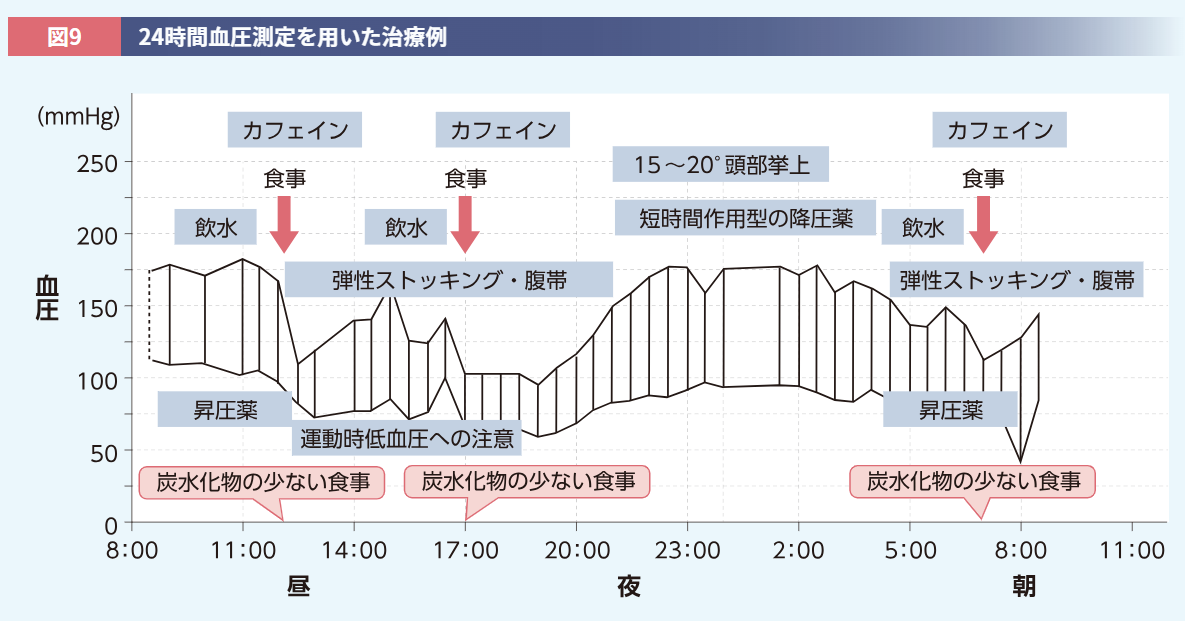 ALC_24時間血圧測定を用いた治療例