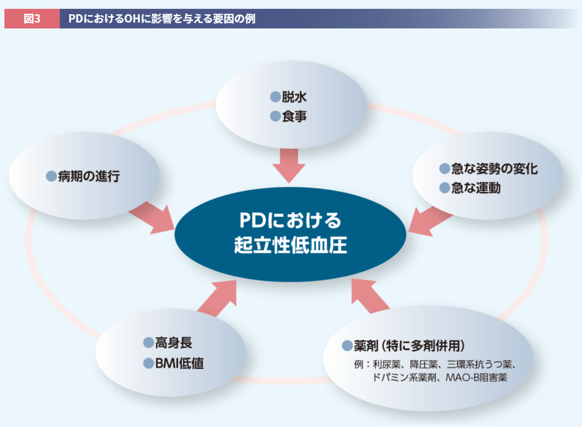 ALC_PDにおけるOHに影響を与える要因の例