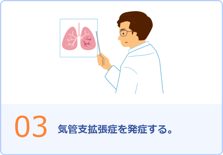 03 気管支拡張症を発症する。