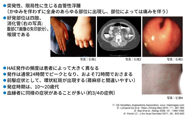 図 HAEの臨床的特徴