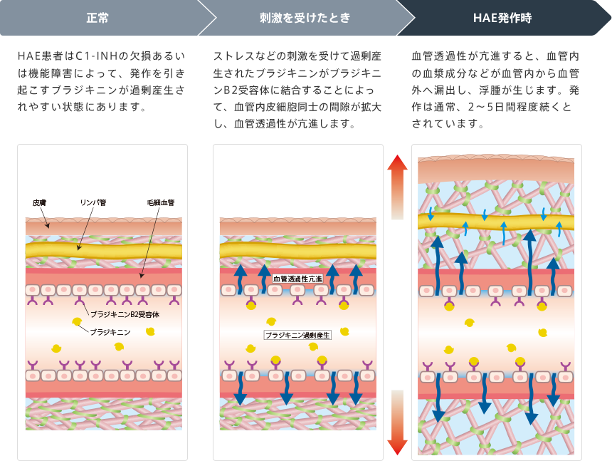 腫れやむくみが起こるときの経過