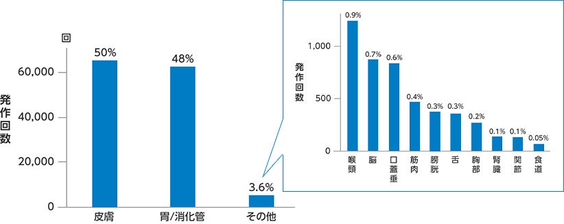 皮膚、腹部、その他臓器における発作頻度