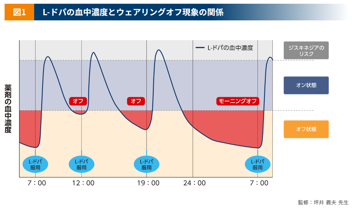 ALC_L-ドパの血中濃度とウェアリングオフ現象の関係